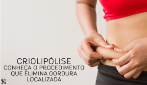 Criolipólise: conheça o procedimento que elimina gordura localizada