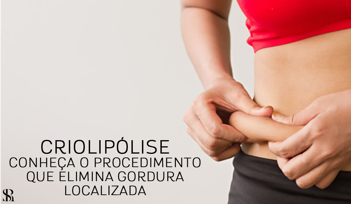 Criolipólise- conheça o procedimento que elimina gordura localizada