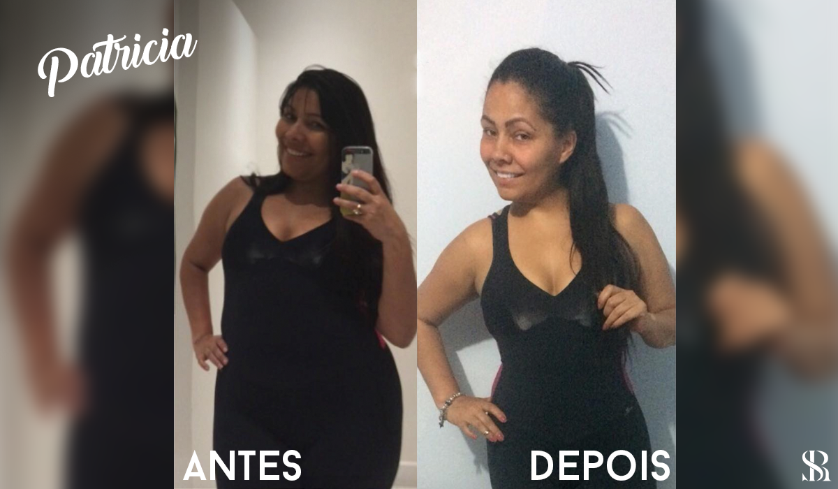 Antes e depois - Finalmente Magro 